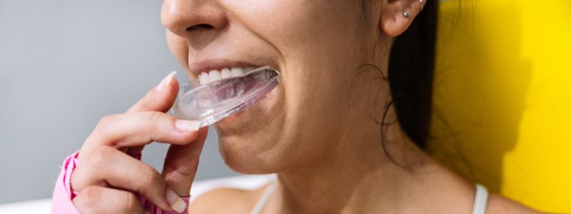 Woman inserting sports guard into mouth